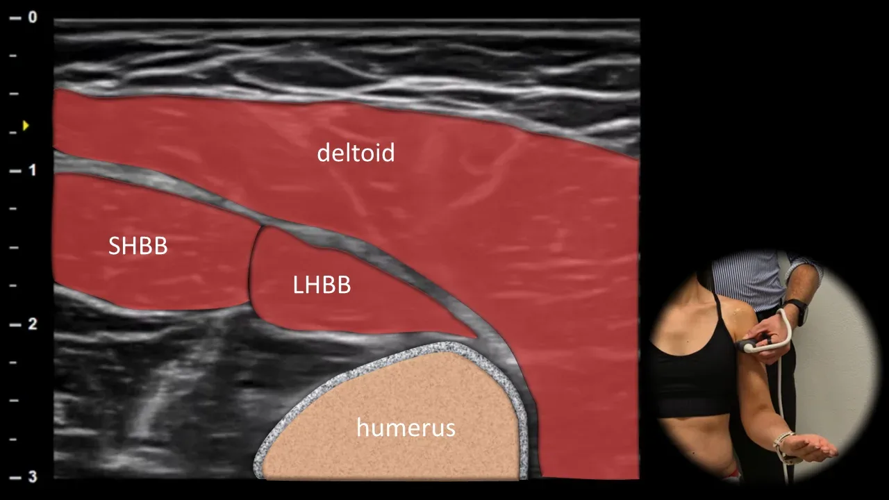 Figure 2 with labels