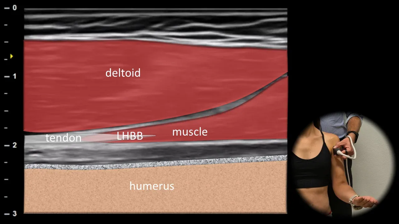 Figure 4 with labels