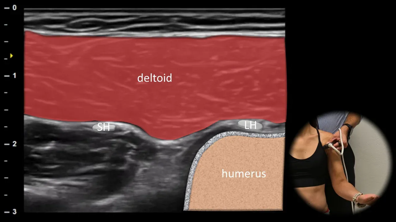 Figure 5 with labels