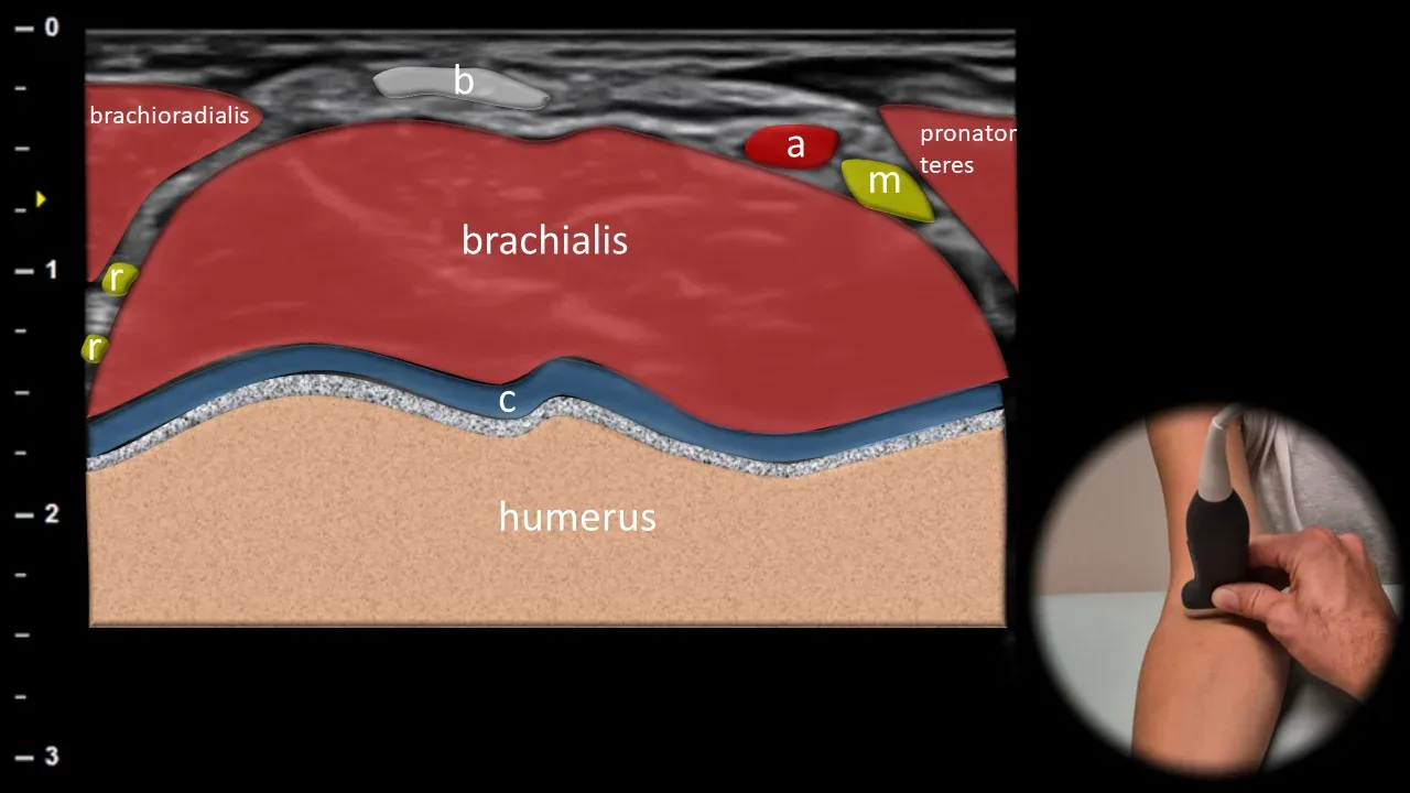 Figure 11 with labels