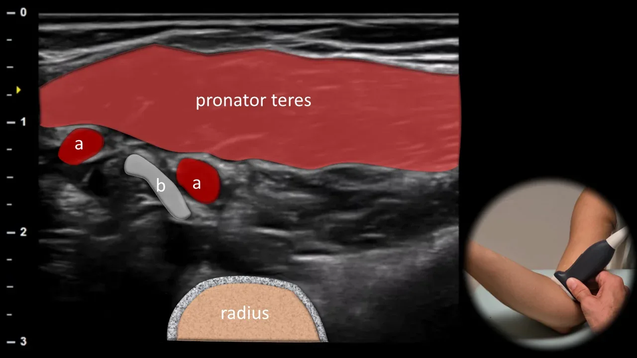 Figure 13 with labels