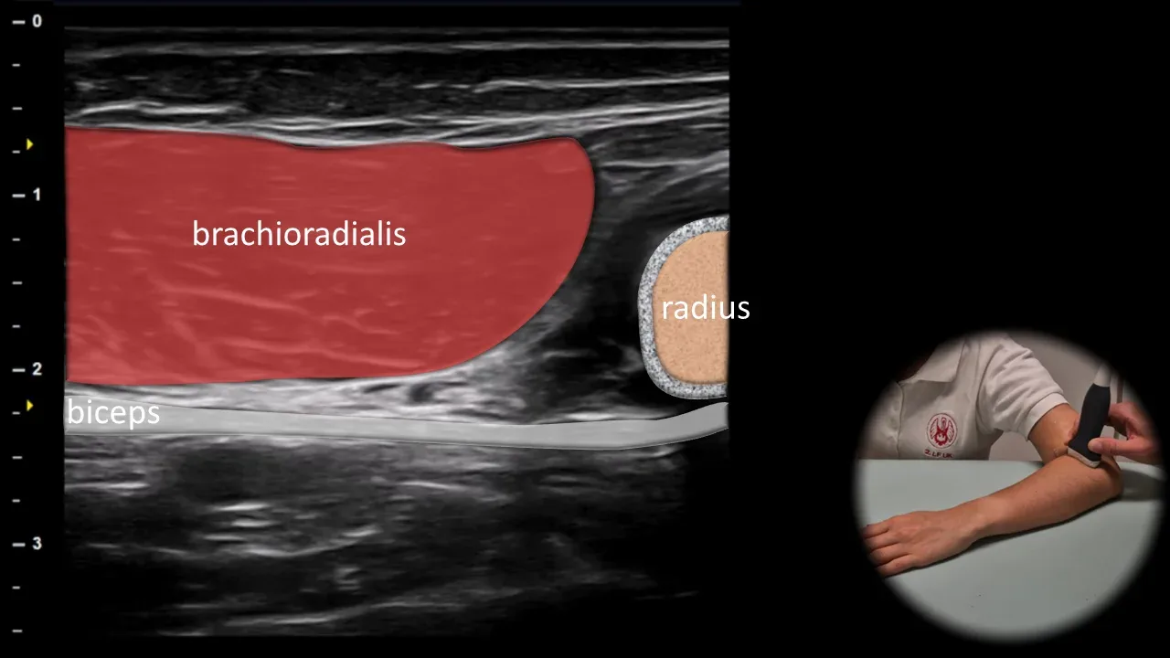 Figure 15 with labels