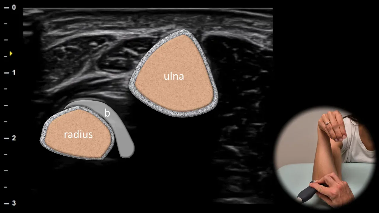 Figure 16 with labels