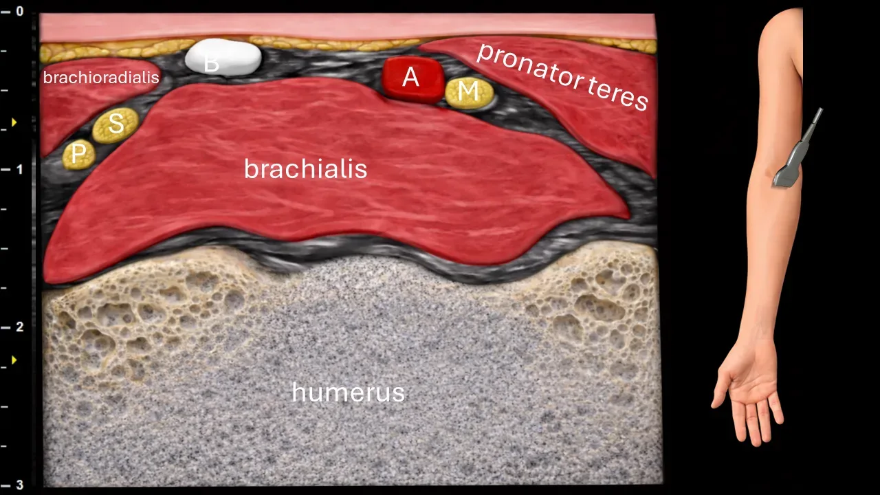 Figure 5 with labels