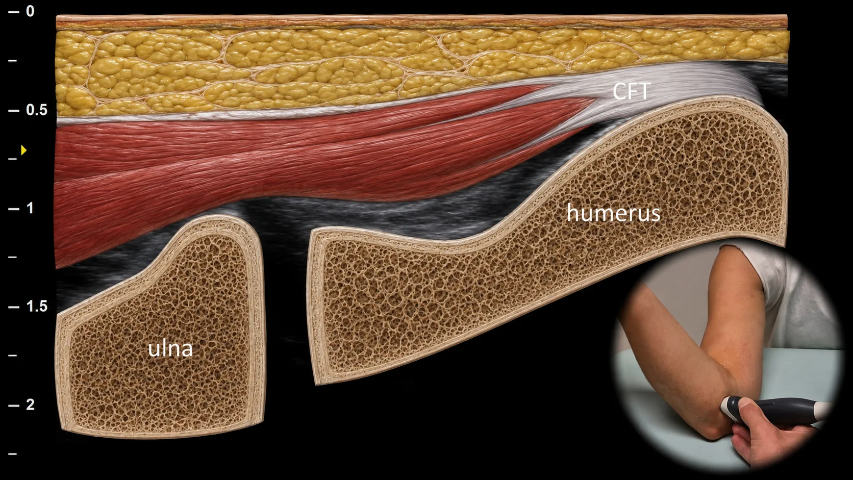 Figure 4 overlay