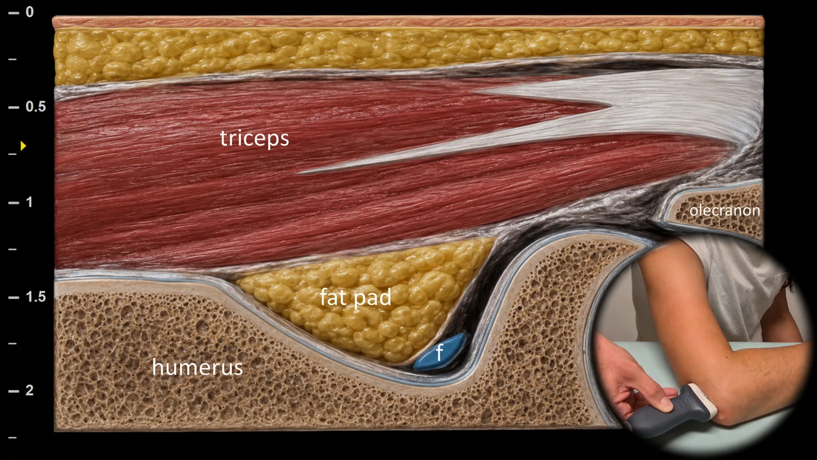 Figure 6 overlay